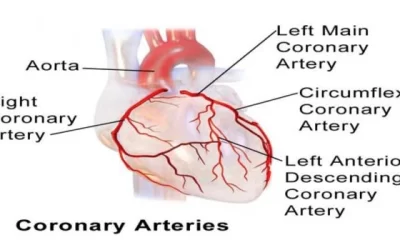 Arterial Blood Supply to the Heart