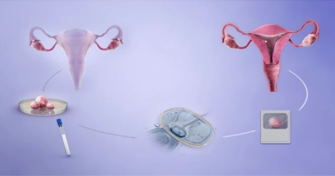 artificial reproductive techniques