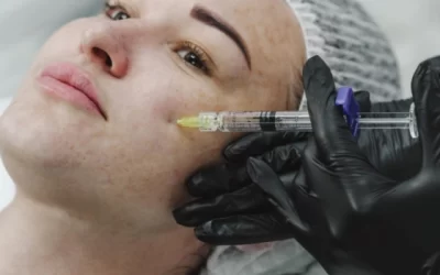CDC Reports Multiple HIV Infections Linked to Unsanitary Vampire Facials in New Mexico